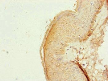 Immunohistochemistry of paraffin-embedded human skin tissue using NDUFB10 Antibody at dilution of 1:100Rabbit anti-Human NDUFB10 Polyclonal Antibody