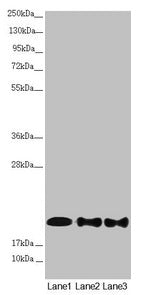 Western blot  | All lanes: NDUFB10 antibody at 2.42µg/ml  | Lane 1: Mouse brain tissue  | Lane 2: HepG2 whole cell lysate  | Lane 3: 293T whole cell lysate  | Secondary  | Goat polyclonal to rabbit IgG at 1/10000 dilution  | Predicted band size: 21 kDa  | Observed band size: 21 kDaRabbit anti-Human NDUFB10 Polyclonal Antibody