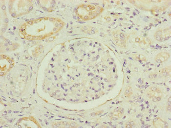Immunohistochemistry of paraffin-embedded human kidney tissue using NDUFB5 Antibody at dilution of 1:100Rabbit anti-Human NDUFB5 Polyclonal Antibody