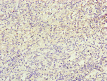 Immunohistochemistry of paraffin-embedded human spleen tissue using NDUFB5 Antibody at dilution of 1:100Rabbit anti-Human NDUFB5 Polyclonal Antibody