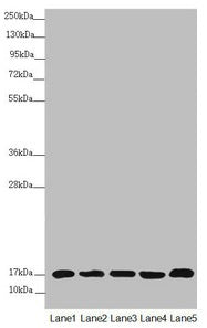 Western blot  | All lanes: NDUFB5 antibody at 2.64µg/ml  | Lane 1: Mouse heart tissue  | Lane 2: Mouse kidney tissue  | Lane 3: 293T whole cell lysate  | Lane 4: Jurkat whole cell lysate  | Lane 5: MCF-7 whole cell lysate  | Secondary  | Goat polyclonal to rabbit IgG at 1/10000 dilution  | Predicted band size: 22, 16 kDa  | Observed band size: 16 kDaRabbit anti-Human NDUFB5 Polyclonal Antibody