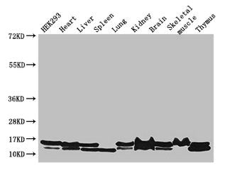 Western Blot  | Positive WB detected in: HEK293 whole cell lysate, Mouse heart tissue, Mouse liver tissue, Mouse spleen tissue, Mouse lung tissue, Mouse kidney tissue, Mouse brain tissue, Mouse skeletal muscle tissue, Mouse thymus tissue  | All lanes: NDUFB6 antibody at 3µg/ml  | Secondary  | Goat polyclonal to rabbit IgG at 1/50000 dilution  | Predicted band size: 16, 14 kDa  | Observed band size: 16, 14 kDaRabbit anti-Human NDUFB6 Polyclonal Antibody