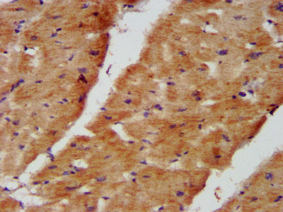 IHC image of NDUFB8 Antibody diluted at 1:400 and staining in paraffin-embedded human heart tissue performed on a Leica BondTM system. After dewaxing and hydration, antigen retrieval was mediated by high pressure in a citrate buffer (pH 6.0). Section was blocked with 10% normal goat serum 30min at RT. Then primary antibody (1% BSA) was incubated at 4°C overnight. The primary is detected by a biotinylated secondary antibody and visualized using an HRP conjugated SP system.Rabbit anti-Human NDUFB8 Polyclonal Antibody