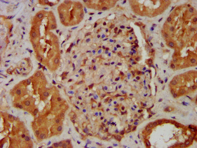 IHC image of NDUFB8 Antibody diluted at 1:400 and staining in paraffin-embedded human kidney tissue performed on a Leica BondTM system. After dewaxing and hydration, antigen retrieval was mediated by high pressure in a citrate buffer (pH 6.0). Section was blocked with 10% normal goat serum 30min at RT. Then primary antibody (1% BSA) was incubated at 4°C overnight. The primary is detected by a biotinylated secondary antibody and visualized using an HRP conjugated SP system.Rabbit anti-Human NDUFB8 Polyclonal Antibody