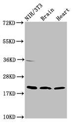Western Blot | Positive WB detected in: NIH/3T3 whole cell lysate, Rat brain tissue, Mouse heart tissue | All lanes: NDUFB8 antibody at 2μg/ml | Secondary | Goat polyclonal to rabbit IgG at 1/50000 dilution | Predicted band size: 22, 21, 19 kDa | Observed band size: 22 kDaRabbit anti-Human NDUFB8 Polyclonal Antibody