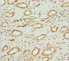 Immunohistochemistry of paraffin-embedded human kidney tissue using NDUFS1 Antibody at dilution of 1:100Rabbit anti-Human NDUFS1 Polyclonal Antibody