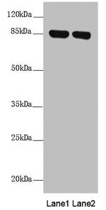 Western blot | All lanes: NDUFS1 antibody at 2.41 μg/ml | Lane 1: Mouse heart tissue | Lane 2: Mouse kidney tissue | Secondary | Goat polyclonal to rabbit IgG at 1/10000 dilution | Predicted band size: 80, 81, 68, 74, 76 kDa | Observed band size: 80 kDaRabbit anti-Human NDUFS1 Polyclonal Antibody