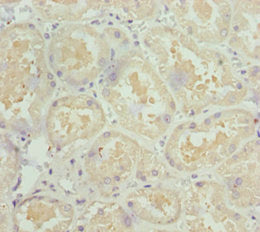 Immunohistochemistry of paraffin-embedded human kidney tissue using NDUFS1 Antibody at dilution of 1:100Rabbit anti-Human NDUFS1 Polyclonal Antibody