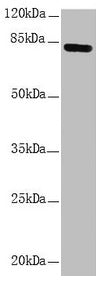 Western blot  | All lanes: NDUFS1 antibody at 1.15µg/ml + HepG2 whole cell lysate  | Secondary  | Goat polyclonal to rabbit IgG at 1/10000 dilution  | Predicted band size: 80, 81, 68, 74, 76 kDa  | Observed band size: 80 kDaRabbit anti-Human NDUFS1 Polyclonal Antibody