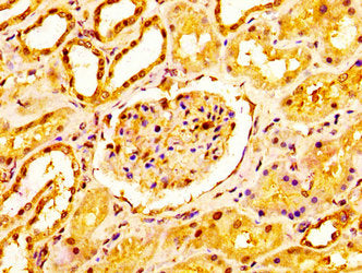 IHC image of NDUFS2 Antibody diluted at 1:200 and staining in paraffin-embedded human kidney tissue performed on a Leica BondTM system. After dewaxing and hydration, antigen retrieval was mediated by high pressure in a citrate buffer (pH 6.0). Section was blocked with 10% normal goat serum 30min at RT. Then primary antibody (1% BSA) was incubated at 4°C overnight. The primary is detected by a biotinylated secondary antibody and visualized using an HRP conjugated SP system.Rabbit anti-Human NDUFS2 Polyclonal Antibody