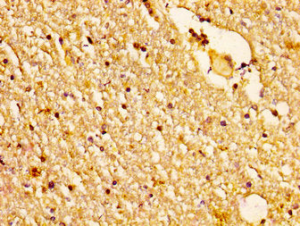 IHC image of NDUFS2 Antibody diluted at 1:200 and staining in paraffin-embedded human brain tissue performed on a Leica BondTM system. After dewaxing and hydration, antigen retrieval was mediated by high pressure in a citrate buffer (pH 6.0). Section was blocked with 10% normal goat serum 30min at RT. Then primary antibody (1% BSA) was incubated at 4°C overnight. The primary is detected by a biotinylated secondary antibody and visualized using an HRP conjugated SP system.Rabbit anti-Human NDUFS2 Polyclonal Antibody