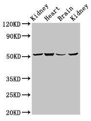 Western Blot | Positive WB detected in: Rat kidney tissue, Mouse heart tissue, Mouse brain tissue, Mouse kidney tissue | All lanes: NDUFS2 antibody at 6.9μg/ml | Secondary | Goat polyclonal to rabbit IgG at 1/50000 dilution | Predicted band size: 53, 52 kDa | Observed band size: 53 kDaRabbit anti-Human NDUFS2 Polyclonal Antibody