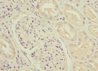 Immunohistochemistry of paraffin-embedded human kidney tissue using NDUFS3 Antibody at dilution of 1:100Rabbit anti-Human NDUFS3 Polyclonal Antibody