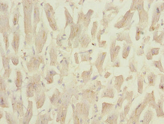 Immunohistochemistry of paraffin-embedded human heart tissue using NDUFS3 Antibody at dilution of 1:100Rabbit anti-Human NDUFS3 Polyclonal Antibody