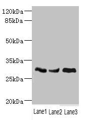 Western blot | All lanes: NDUFS3 antibody at 1.98μg/ml | Lane 1: Mouse brain tissue | Lane 2: Mouse skeletal muscle tissue | Lane 3: Mouse heart tissue | Secondary | Goat polyclonal to rabbit IgG at 1/10000 dilution | Predicted band size: 31, 15 kDa | Observed band size: 31 kDaRabbit anti-Human NDUFS3 Polyclonal Antibody