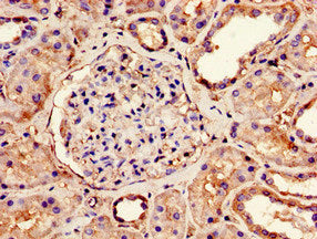 Immunohistochemistry of paraffin-embedded human kidney tissue using NDUFS4 Antibody at dilution of 1:100Rabbit anti-Human NDUFS4 Polyclonal Antibody