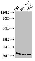Western Blot  | Positive WB detected in: U87 whole cell lysate, SH-SY5Y whole cell lysate, A549 whole cell lysate  | All lanes: NDUFS4 antibody at 2.5µg/ml  | Secondary  | Goat polyclonal to rabbit IgG at 1/50000 dilution  | Predicted band size: 21 kDa  | Observed band size: 21 kDaRabbit anti-Human NDUFS4 Polyclonal Antibody