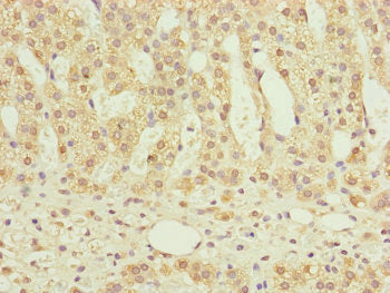 Immunohistochemistry of paraffin-embedded human adrenal gland tissue using NDUFS6 Antibody at dilution of 1:100Rabbit anti-Human NDUFS6 Polyclonal Antibody