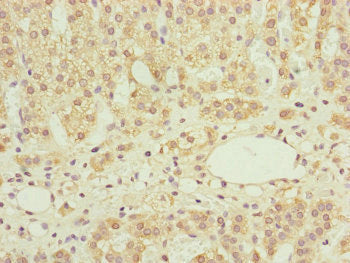Immunohistochemistry of paraffin-embedded human adrenal gland tissue using NDUFS6 Antibody at dilution of 1:100Rabbit anti-Human NDUFS6 Polyclonal Antibody