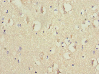 Immunohistochemistry of paraffin-embedded human brain tissue using NDUFV1 Antibody at dilution of 1:100Rabbit anti-Human NDUFV1 Polyclonal Antibody