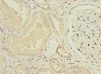 Immunohistochemistry of paraffin-embedded human kidney tissue using NDUFV1 Antibody at dilution of 1:100Rabbit anti-Human NDUFV1 Polyclonal Antibody