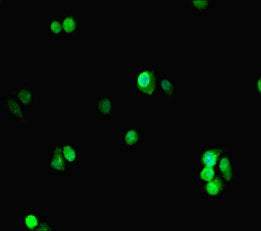 Immunofluorescent analysis of HepG2 cells using PCNA Antibody at dilution of 1:100 and Alexa Fluor 488-congugated AffiniPure Goat Anti-Rabbit IgG(H+L)Rabbit anti-Human PCNA Polyclonal Antibody