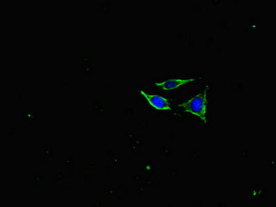 Immunofluorescent analysis of SH-SY5Y cells using NEFL Antibody at dilution of 1:100 and Alexa Fluor 488-congugated AffiniPure Goat Anti-Rabbit IgG(H+L)Rabbit anti-Human NEFL Polyclonal Antibody