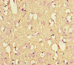 Immunohistochemistry of paraffin-embedded human brain tissue using the antibody at dilution of 1:100Rabbit anti-Human NEFL Polyclonal Antibody