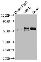 Immunoprecipitating NEFL in mouse brain tissue | Lane 1: Rabbit control IgG instead of NEFL Antibody in mouse brain tissue. | For western blotting, a HRP-conjugated Protein G antibody was used as the secondary antibody (1/2000) | Lane 2: NEFL Antibody (8μg) + Mouse brain tissue (500μg) | Lane 3: Mouse brain tissue (10μg)Rabbit anti-Human NEFL Polyclonal Antibody