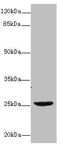 Western blot  | All lanes: NEGR1 antibody at 4µg/ml + U87 whole cell lysate  | Secondary  | Goat polyclonal to rabbit IgG at 1/10000 dilution  | Predicted band size: 39, 25 kDa  | Observed band size: 25 kDaRabbit anti-Human NEGR1 Polyclonal Antibody