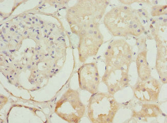 Immunohistochemistry of paraffin-embedded human kidney tissue using NEK3 Antibody at dilution of 1:100Rabbit anti-Human NEK3 Polyclonal Antibody