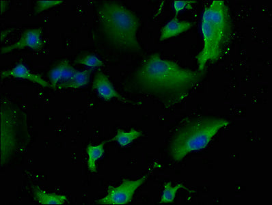 Immunofluorescence staining of U251 cells with NEURL1B Antibody at 1:133, counter-stained with DAPI. The cells were fixed in 4% formaldehyde, permeabilized using 0.2% Triton X-100 and blocked in 10% normal Goat Serum. The cells were then incubated with the antibody overnight at 4°C. The secondary antibody was Alexa Fluor 488-congugated AffiniPure Goat Anti-Rabbit IgG(H+L).Rabbit anti-Human NEURL1B Polyclonal Antibody