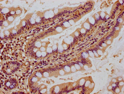 IHC image of NEURL1B Antibody diluted at 1:400 and staining in paraffin-embedded human small intestine tissue performed on a Leica BondTM system. After dewaxing and hydration, antigen retrieval was mediated by high pressure in a citrate buffer (pH 6.0). Section was blocked with 10% normal goat serum 30min at RT. Then primary antibody (1% BSA) was incubated at 4°C overnight. The primary is detected by a biotinylated secondary antibody and visualized using an HRP conjugated SP system.Rabbit anti-Human NEURL1B Polyclonal Antibody