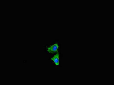 Immunofluorescent analysis of Hela cells using NF2 Antibody at dilution of 1:100 and Alexa Fluor 488-congugated AffiniPure Goat Anti-Rabbit IgG(H+L)Rabbit anti-Human NF2 Polyclonal Antibody