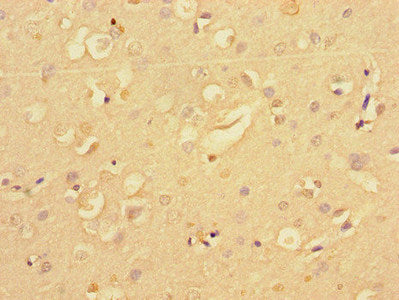 Immunohistochemistry of paraffin-embedded human brain tissue using NF2 Antibody at dilution of 1:100Rabbit anti-Human NF2 Polyclonal Antibody