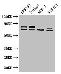 Western Blot | Positive WB detected in: HEK293 whole cell lysate, Jurkat whole cell lysate, MCF-7 whole cell lysate, NIH/3T3 whole cell lysate | All lanes: NF2 antibody at 2.6μg/ml | Secondary | Goat polyclonal to rabbit IgG at 1/50000 dilution | Predicted band size: 70, 73, 60, 65, 64, 31, 66, 20, 25 kDa | Observed band size: 70, 73 kDaRabbit anti-Human NF2 Polyclonal Antibody