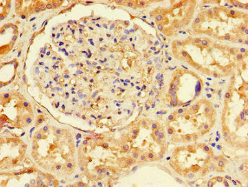 Immunohistochemistry of paraffin-embedded human kidney tissue using NFE2L1 Antibody at dilution of 1:100Rabbit anti-Human NFE2L1 Polyclonal Antibody