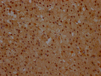 IHC image of NFKBIA Antibody diluted at 1:100 and staining in paraffin-embedded human adrenal gland tissue performed on a Leica BondTM system. After dewaxing and hydration, antigen retrieval was mediated by high pressure in a citrate buffer (pH 6.0). Section was blocked with 10% normal goat serum 30min at RT. Then primary antibody (1% BSA) was incubated at 4°C overnight. The primary is detected by a Goat anti-rabbit polymer IgG labeled by HRP and visualized using 0.05% DAB.Rabbit anti-Human NFKBIA Polyclonal Antibody
