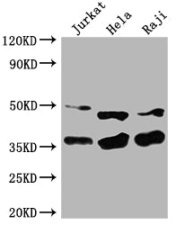 Western Blot | Positive WB detected in: Jurkat whole cell lysate, Hela whole cell lysate, Raji whole cell lysate | All lanes: NFKBIA antibody at 1:2000 | Secondary | Goat polyclonal to rabbit IgG at 1/50000 dilution | Predicted band size: 36 kDa | Observed band size: 36 kDaRabbit anti-Human NFKBIA Polyclonal Antibody