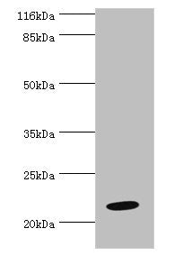 Western blot  | All lanes: NME6 antibody at 2µg/ml + Hela whole cell lysate  | Secondary  | Goat polyclonal to rabbit IgG at 1/10000 dilution  | Predicted band size: 22, 14, 19 kDa  | Observed band size: 22 kDaRabbit anti-Human NME6 Polyclonal Antibody