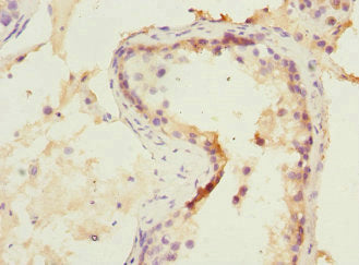 Immunohistochemistry of paraffin-embedded human testis tissue using the antibody at dilution of 1:100Rabbit anti-Human NMT2 Polyclonal Antibody