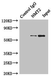Immunoprecipitating NMT2 in HepG2 whole cell lysate | Lane 1: Rabbit control IgG instead of (1μg) instead of NMT2 Antibody in HepG2 whole cell lysate. | For western blotting, a HRP-conjugated anti-rabbit IgG, specific to the non-reduced form of IgG was used as the Secondary antibody (1/50000) | Lane 2: NMT2 Antibody (4μg) + HepG2 whole cell lysate (500μg) | Lane 3: HepG2 whole cell lysate (20μg)Rabbit anti-Human NMT2 Polyclonal Antibody