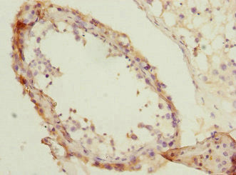 Immunohistochemistry of paraffin-embedded human testis tissue using NMT2 Antibody at dilution of 1:100Rabbit anti-Human NMT2 Polyclonal Antibody