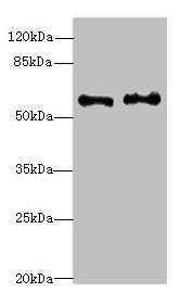 Western blot | All lanes: NMT2 antibody at 4.99μg/ml | Lane 1: Human placenta tissue | Lane 2: K562 whole cell lysate | Secondary | Goat polyclonal to rabbit IgG at 1/10000 dilution | Predicted band size: 57 kDa | Observed band size: 57 kDaRabbit anti-Human NMT2 Polyclonal Antibody