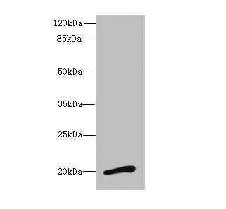 Western blot | All lanes: NMUantibody at 3.13μg/ml + Mouse stomach tissue | Secondary | Goat polyclonal to rabbit IgG at 1/10000 dilution | Predicted band size: 20 kDa | Observed band size: 20 kDaRabbit anti-Human NMU Polyclonal Antibody