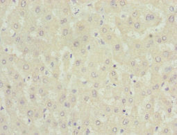 Immunohistochemistry of paraffin-embedded human liver tissue using NNMT Antibody at dilution of 1:100Rabbit anti-Human NNMT Polyclonal Antibody