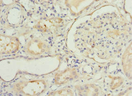 Immunohistochemistry of paraffin-embedded human kidney tissue using NNMT Antibody at dilution of 1:100Rabbit anti-Human NNMT Polyclonal Antibody