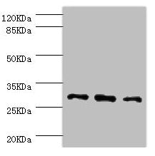 Western blot  | All lanes: NNMT antibody at 2.47µg/ml  | Lane 1: HepG2 whole cell lysate  | Lane 2: Hela whole cell lysate  | Lane 3: A549 whole cell lysate  | Secondary  | Goat polyclonal to rabbit IgG at 1/10000 dilution  | Predicted band size: 30 kDa  | Observed band size: 30 kDaRabbit anti-Human NNMT Polyclonal Antibody