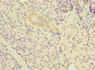 Immunohistochemistry of paraffin-embedded human pancreatic tissue using NOL10 Antibody at dilution of 1:100Rabbit anti-Human NOL10 Polyclonal Antibody