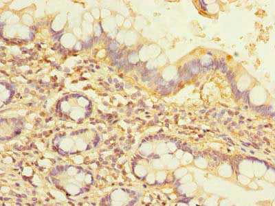 Immunohistochemistry of paraffin-embedded human small intestine tissue using NOL10 Antibody at dilution of 1:100Rabbit anti-Human NOL10 Polyclonal Antibody